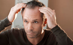 Recognising the Warning Signs: A Comprehensive Guide to Early Hair Loss Detection and Prevention