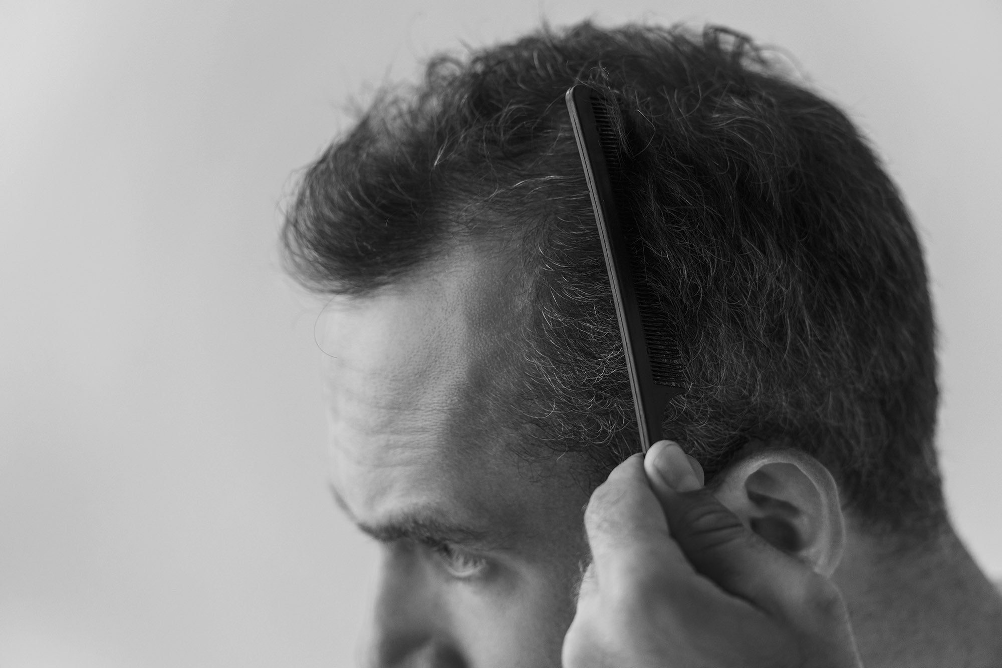 Hair Loss
